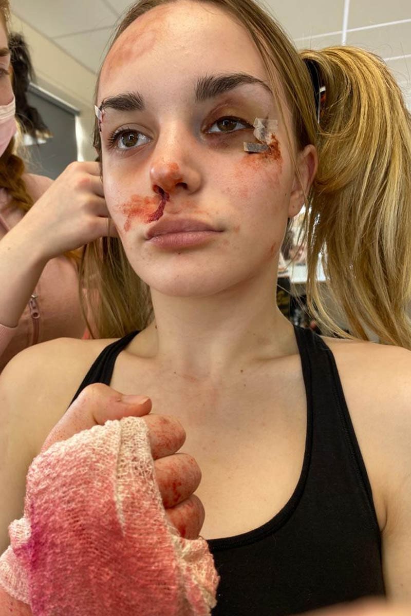 Boxing Cuts SFX Makeup4