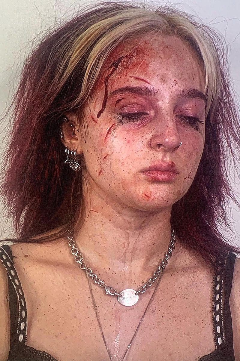 Girl with cuts and bruises Girl with Phone - 800 x 1200