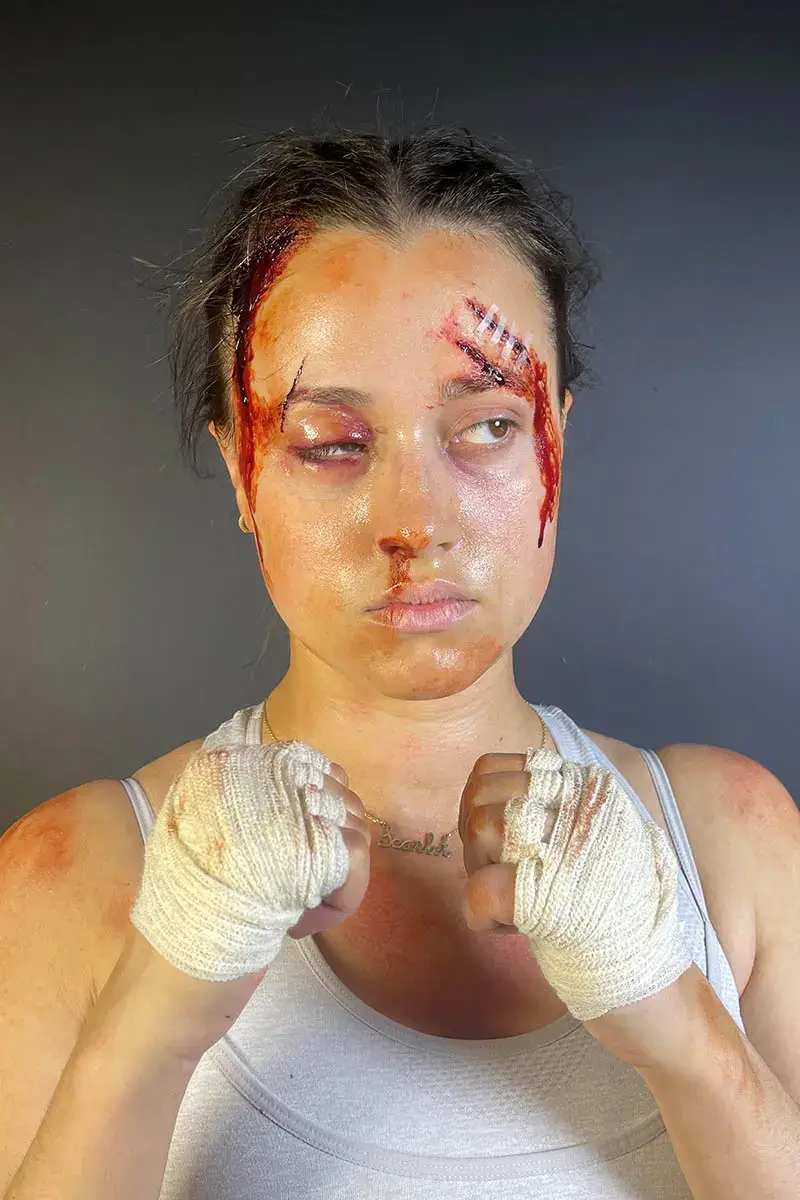 A detailed prosthetic transformation