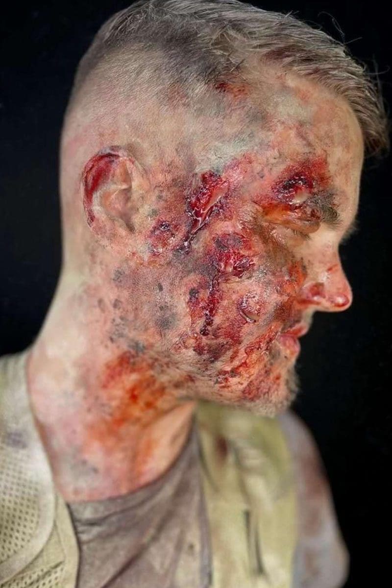 Bald cap and prosthetics